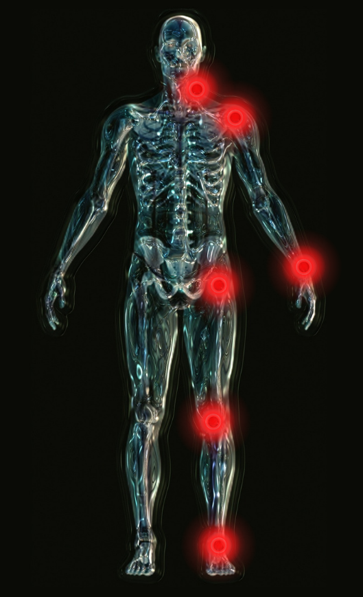Joint Inflammation Human Body